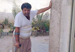 این جانباز جنگ‌ تحمیلی را دریابید