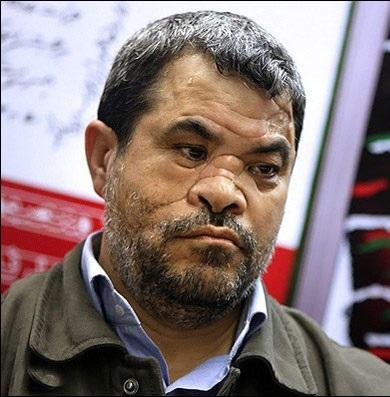 زخم‌های شیرین جنگ از زبان نورالدین