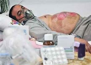 هيروشيما؛ شهري در ايران