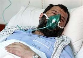 روایت‌های یک جانباز شیمیایی از تاوان عاشقی