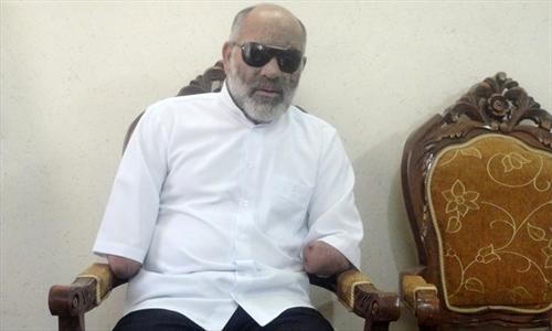 جانبازی که دست‌ها و چشم‌هایش را در سردشت جا گذاشت