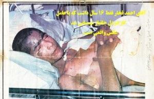 جانباز بجستانی فقط ۱۶ سال داشت که توسط گاز خردل شیمیایی شد