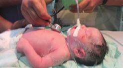 تصوير جنيني كه صهيونيست‌ها مادرش را شهيد كردند