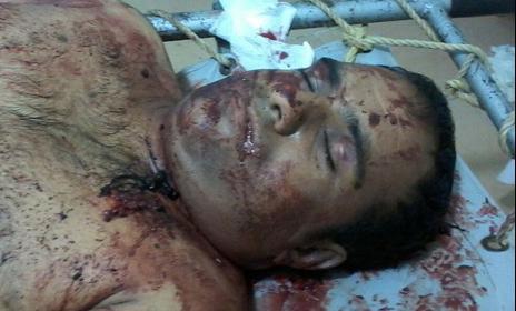 پیکر بسیجی اهل تسنن پس از ترور 